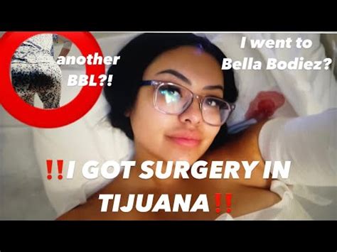 bella bodiez botched